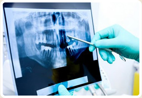 Radiographie Patient